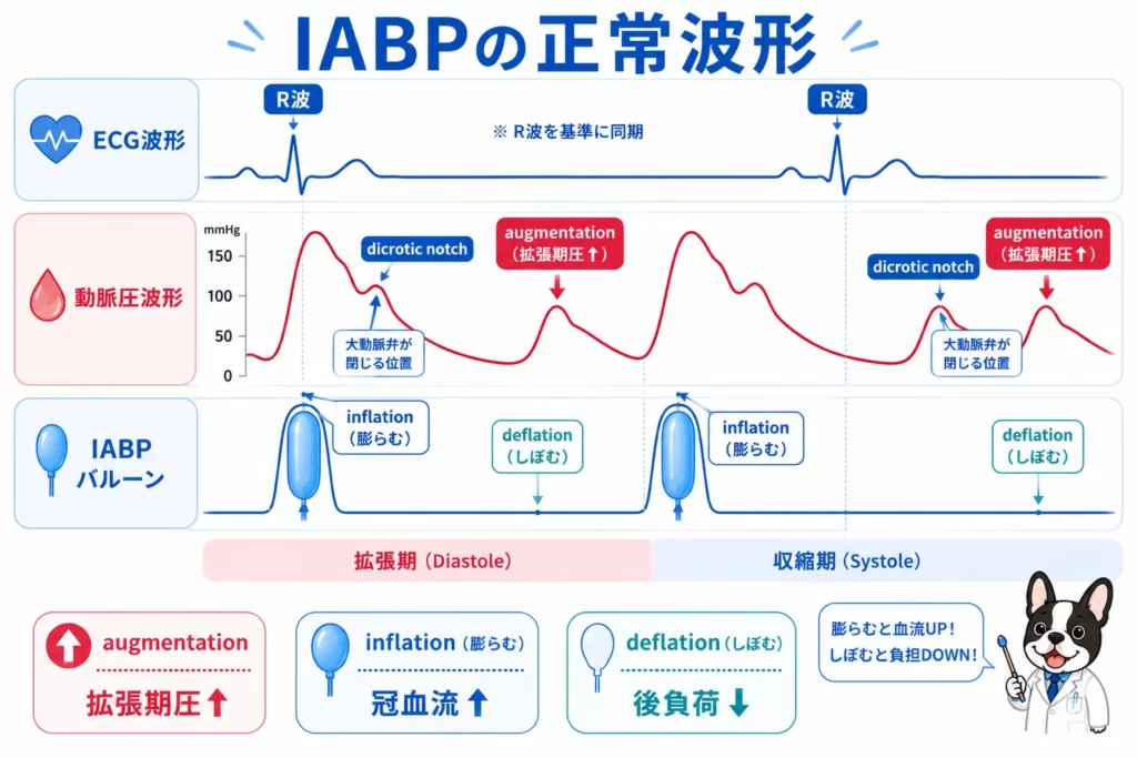 IABPの正常波形とinflation・deflationを解説した初心者向け図解