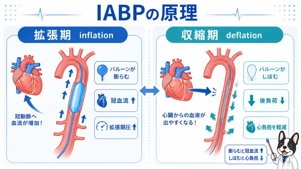 IABPのinflationとdeflationの原理を解説した初心者向け医療図解